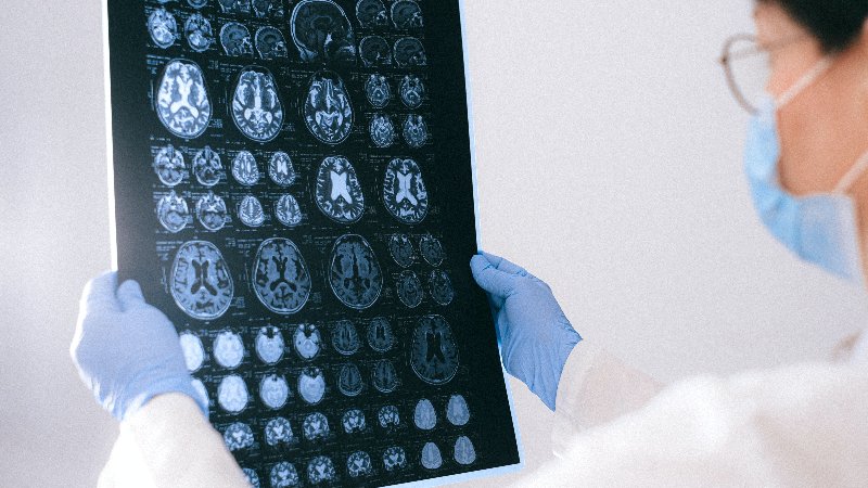 doctor looking at brain scan for traumatic brain injury